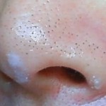 鼻の黒ずみを治す洗顔の方法は朝するべき？